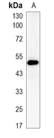1 - Recombinant Anti-Beta-arrestin-1 Rabbit mAb AP94896