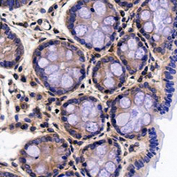 19 - Recombinant Anti-ROCK1 Rabbit mAb AP94897