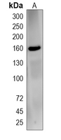 1 - Recombinant Anti-ROCK1 Rabbit mAb AP94897