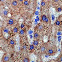19 - Recombinant Anti-TRK A Rabbit mAb AP94898
