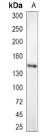 1 - Recombinant Anti-TRK A Rabbit mAb AP94898