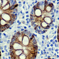 19 - Recombinant Anti-Cytokeratin 20 Rabbit mAb AP94899