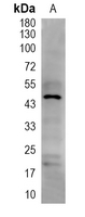 1 - Recombinant Anti-Cytokeratin 20 Rabbit mAb AP94899