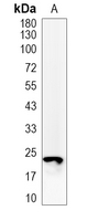 1 - Recombinant Anti-CD9 Rabbit mAb AP94900