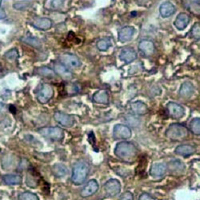 19 - Recombinant Anti-Cathepsin D Rabbit mAb AP94901