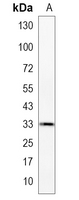 1 - Recombinant Anti-Cathepsin D Rabbit mAb AP94901