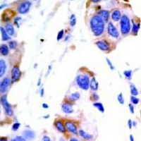 19 - Recombinant Anti-ASK1 Rabbit mAb AP94903