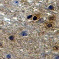 19 - Recombinant Anti-PAK1/2/3 (Phospho-S144/141/154) Rabbit mAb AP94904