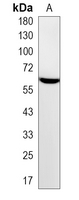 1 - Recombinant Anti-PAK1/2/3 (Phospho-S144/141/154) Rabbit mAb AP94904