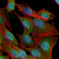 3 - Recombinant Anti-Calreticulin Rabbit mAb AP94905