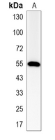 1 - Recombinant Anti-Calreticulin Rabbit mAb AP94905