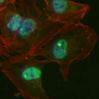 3 - Recombinant Anti-PKC alpha Rabbit mAb AP94906