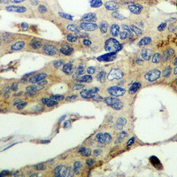 19 - Recombinant Anti-PKC alpha Rabbit mAb AP94906
