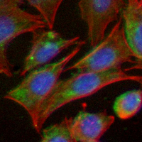 3 - Recombinant Anti-S6K1 Rabbit mAb AP94907