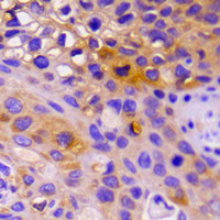 19 - Recombinant Anti-S6K1 Rabbit mAb AP94907