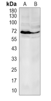 1 - Recombinant Anti-S6K1 Rabbit mAb AP94907