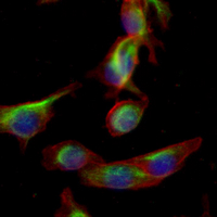 3 - Recombinant Anti-BAD Rabbit mAb AP94908