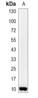 1 - Recombinant Anti-NDUFAB1 Rabbit mAb AP94909