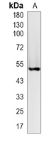 1 - Recombinant Anti-RUNX1/2/3 Rabbit mAb AP94910
