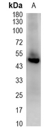 1 - Recombinant Anti-Gamma-tubulin Rabbit mAb AP94911