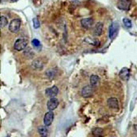 19 - Recombinant Anti-DUSP6 Rabbit mAb AP94913