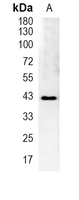 1 - Recombinant Anti-DUSP6 Rabbit mAb AP94913