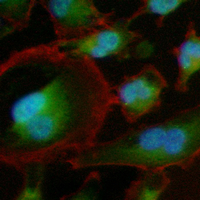 3 - Recombinant Anti-TPP2 Rabbit mAb AP94916