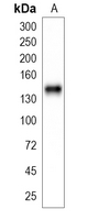 1 - Recombinant Anti-TPP2 Rabbit mAb AP94916