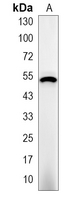 1 - Recombinant Anti-Alpha-tubulin (Acetyl-K40) Rabbit mAb AP94917
