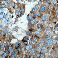 19 - Recombinant Anti-PUMA Rabbit mAb AP94918