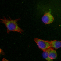 3 - Recombinant Anti-STMN1 Rabbit mAb AP94919