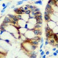 19 - Recombinant Anti-STMN1 Rabbit mAb AP94919