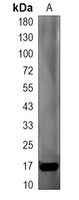 1 - Recombinant Anti-STMN1 Rabbit mAb AP94919