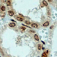 19 - Recombinant Anti-YBX1 Rabbit mAb AP94920