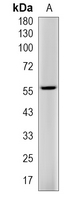 1 - Recombinant Anti-c-SRC (Phospho-Y419) Rabbit mAb AP94922