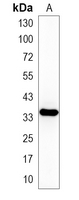 1 - Recombinant Anti-p38 Rabbit mAb AP94924