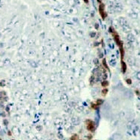 19 - Recombinant Anti-Caspase 2 Rabbit mAb AP94925