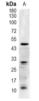 1 - Recombinant Anti-Caspase 2 Rabbit mAb AP94925