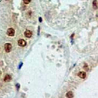 19 - Recombinant Anti-IRF1 Rabbit mAb AP94927