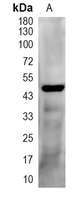1 - Recombinant Anti-IRF1 Rabbit mAb AP94927