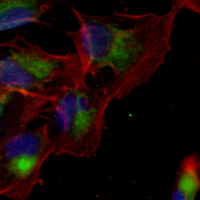 3 - Recombinant Anti-Cytokeratin 17 Rabbit mAb AP94928