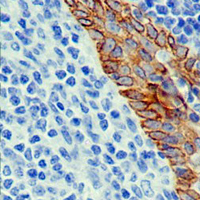 19 - Recombinant Anti-Cytokeratin 17 Rabbit mAb AP94928