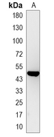 1 - Recombinant Anti-Cytokeratin 17 Rabbit mAb AP94928