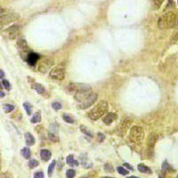 19 - Recombinant Anti-CD222 Rabbit mAb AP94929