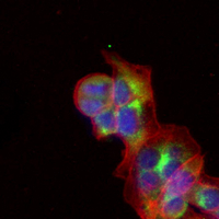 3 - Recombinant Anti-Hexokinase 1 Rabbit mAb AP94932