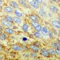 19 - Recombinant Anti-Hexokinase 1 Rabbit mAb AP94932