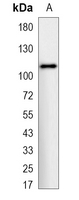 1 - Recombinant Anti-Hexokinase 1 Rabbit mAb AP94932