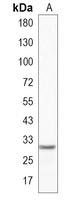 1 - Recombinant Anti-LIN28B Rabbit mAb AP94934