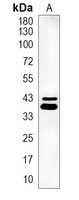 1 - Recombinant Anti-SIRT2 Rabbit mAb AP94935