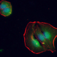 3 - Recombinant Anti-HSP90 alpha/beta Rabbit mAb AP94936